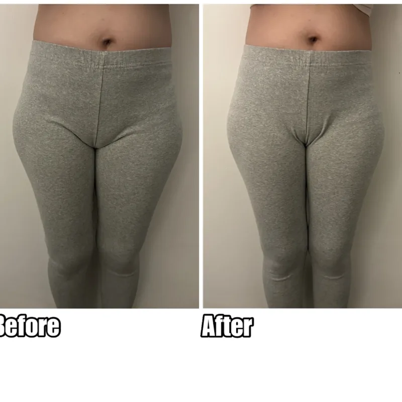 {"ARInfo":{"IsUseAR":false},"Version":"1.0.0","MakeupInfo":{"IsUseMakeup":false},"FaceliftInfo":{"IsChangeEyeLift":false,"IsChangeFacelift":false,"IsChangePostureLift":false,"IsChangeNose":false,"IsChangeFaceChin":false,"IsChangeMouth":false,"IsChangeThinFace":true},"BeautyInfo":{"SwitchMedicatedAcne":false,"IsAIBeauty":false,"IsBrightEyes":false,"IsSharpen":false,"IsOldBeauty":false,"IsReduceBlackEyes":false},"HandlerInfo":{"AppName":2},"FilterInfo":{"IsUseFilter":false}}